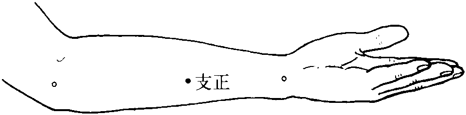 第四節(jié) 眩暈癥